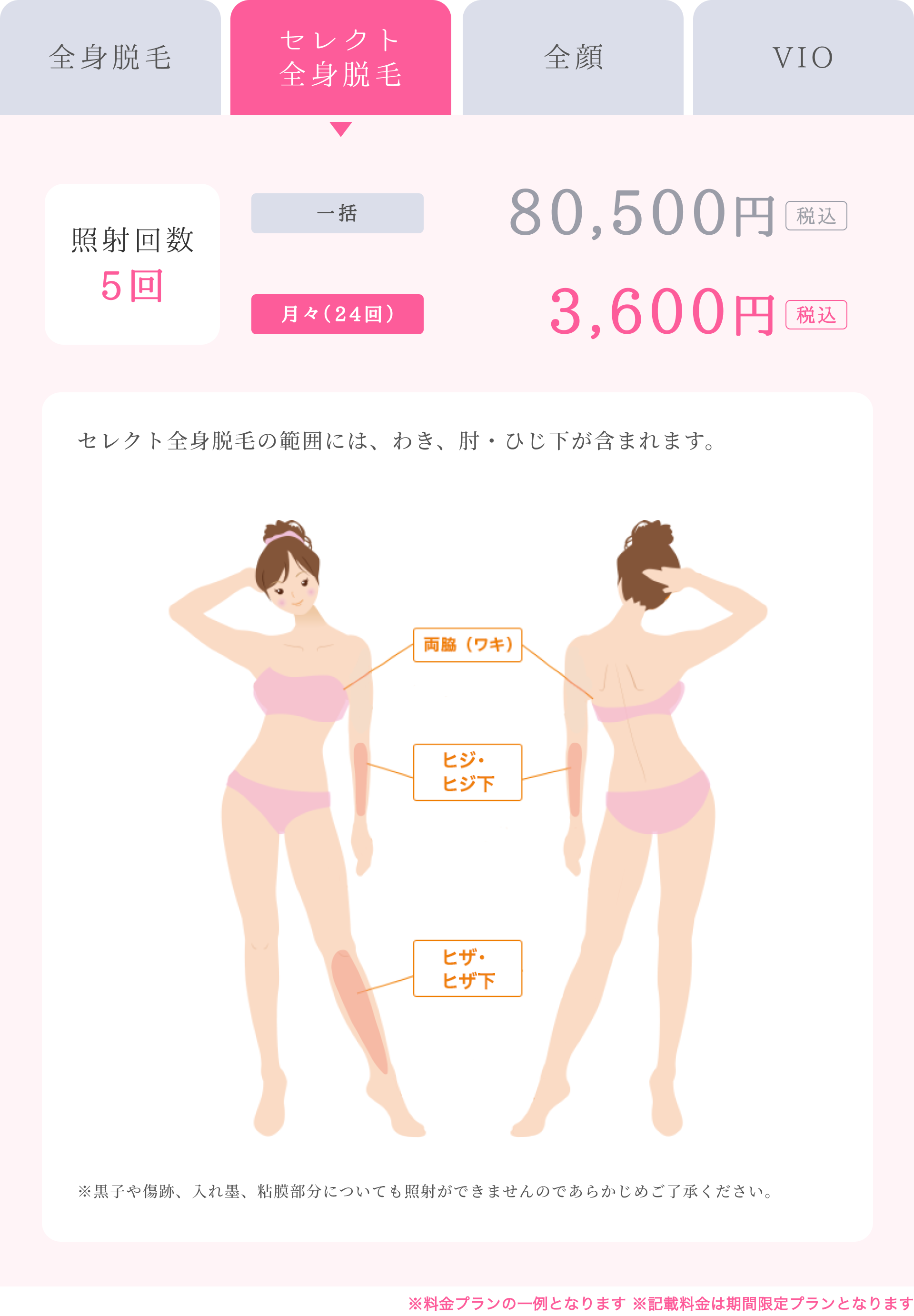 セレクト全身脱毛