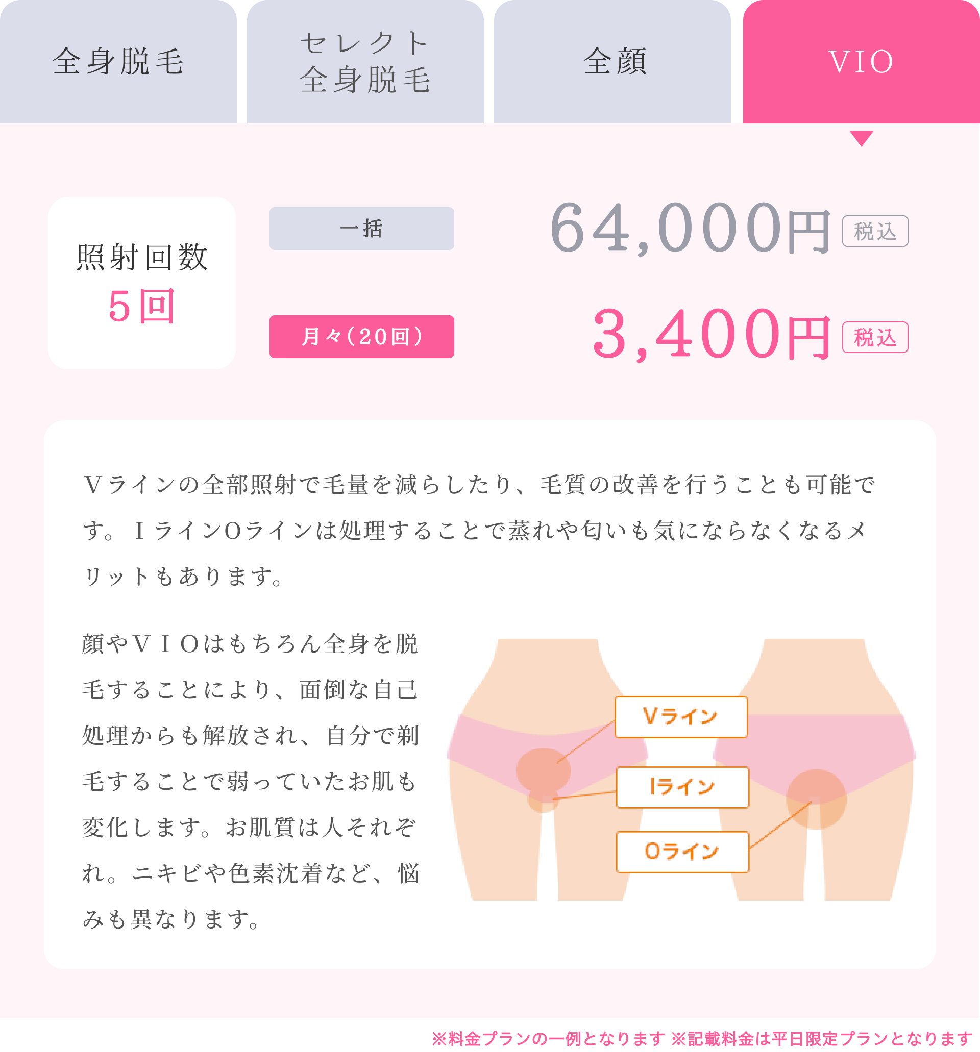 VIO