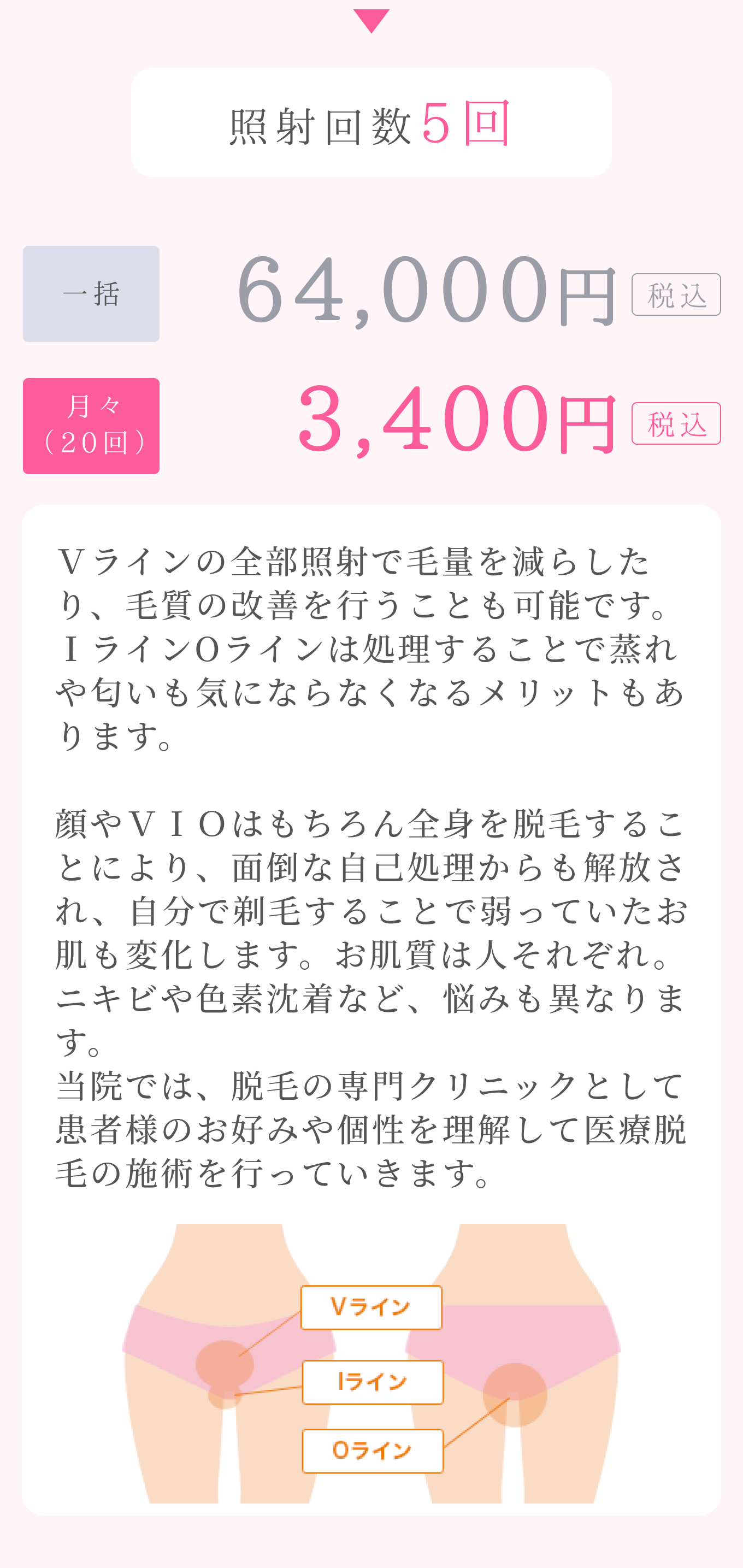 VIO