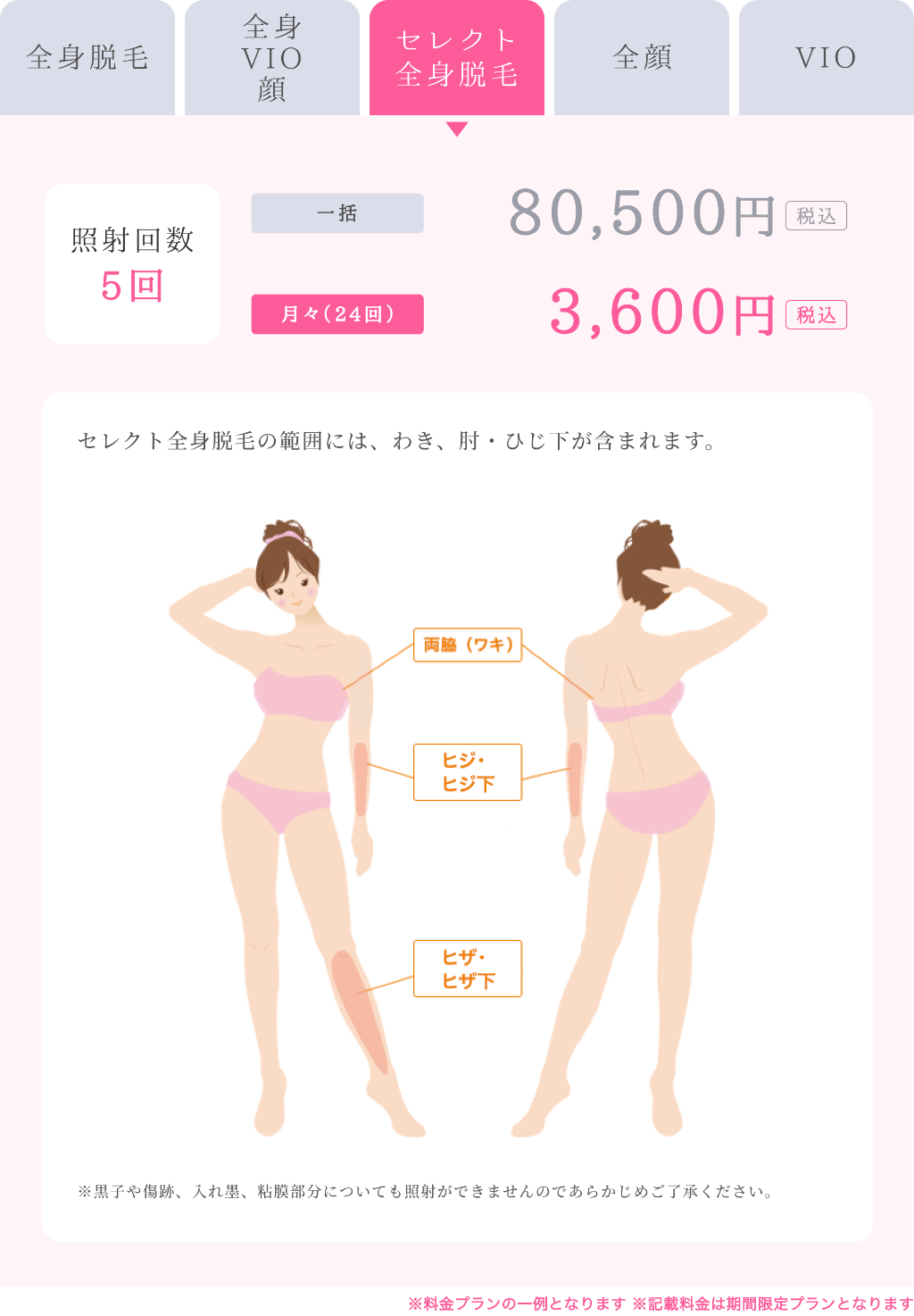 セレクト全身脱毛