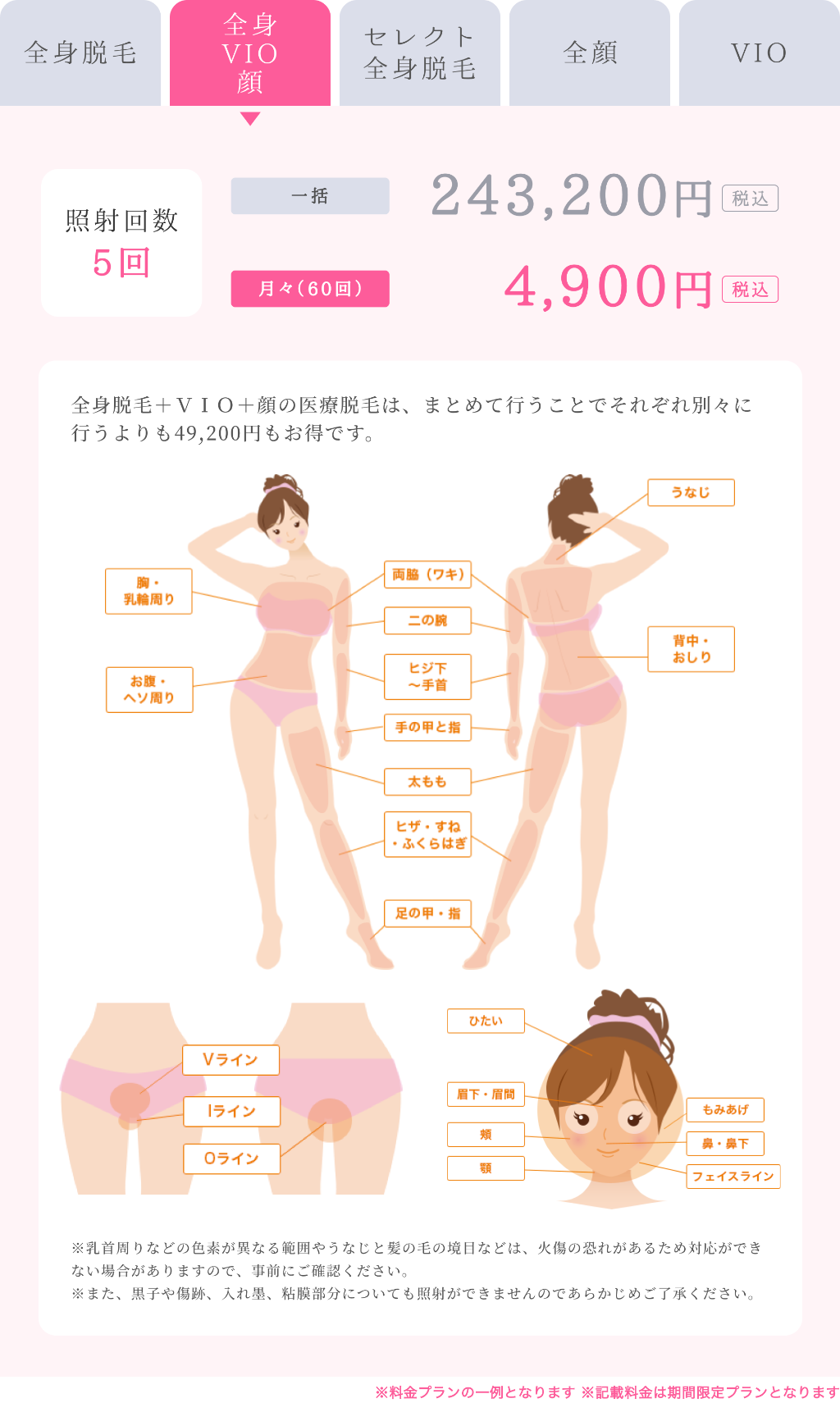 セレクト全身脱毛