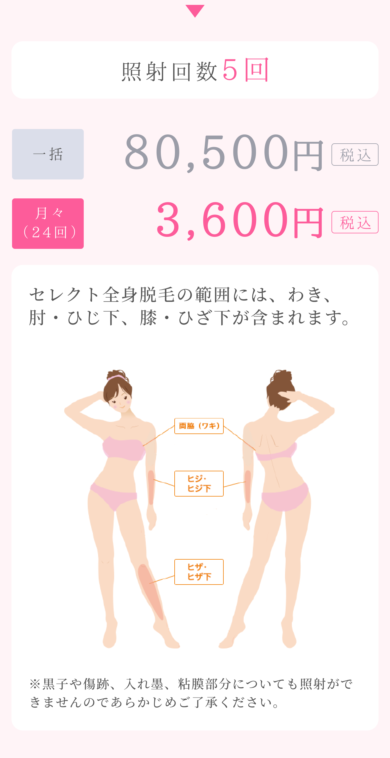 セレクト全身脱毛