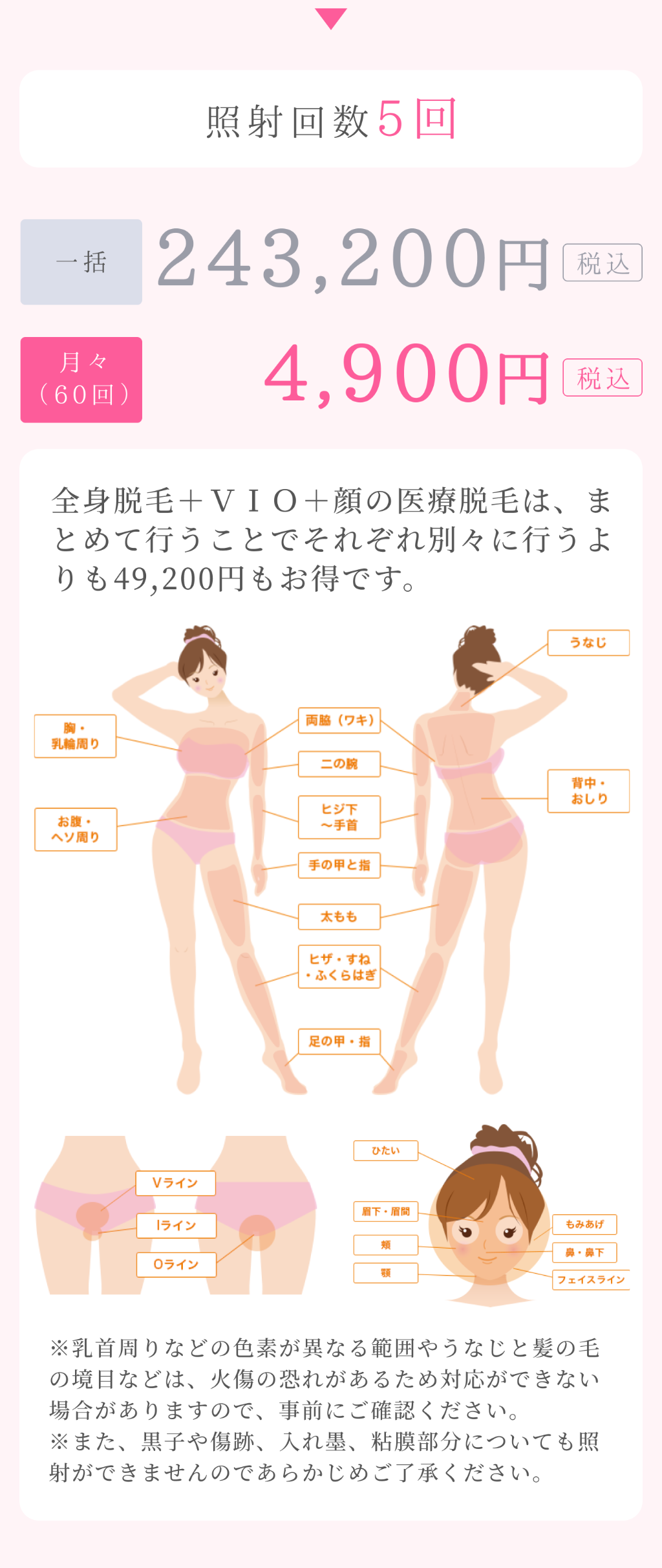 全身VIO全顔脱毛